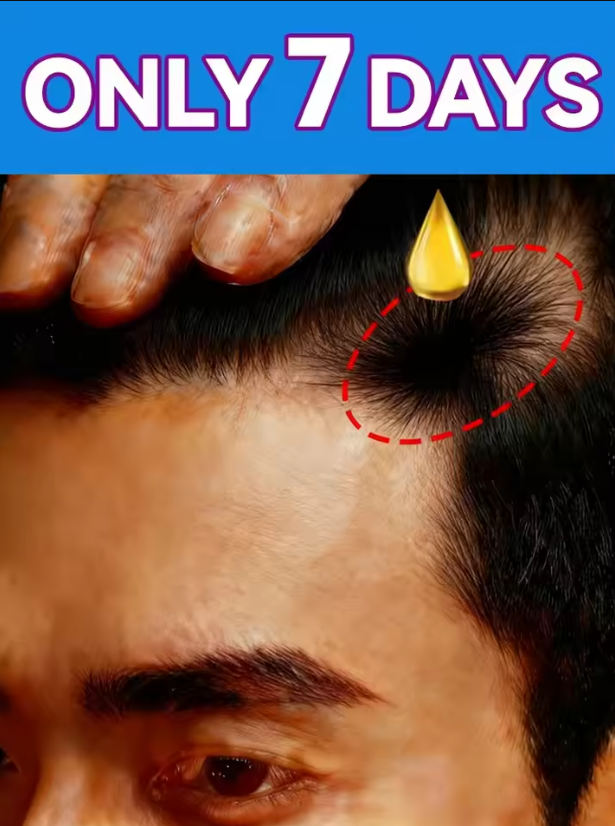 Hair Care Essence Oil - Biotin fast Hair Growth oil Products