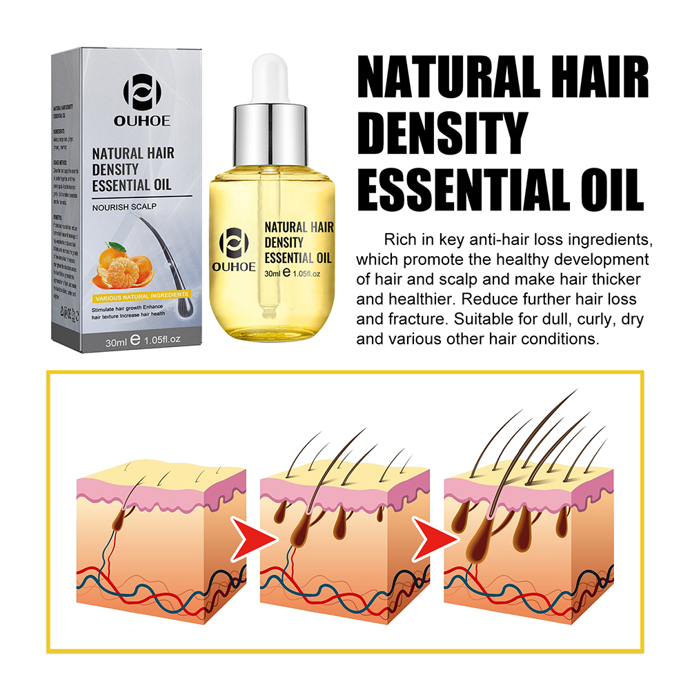 1/2PCS Ginger Hair Growth Oil  - Hair Care Ginseng のレビューと価格