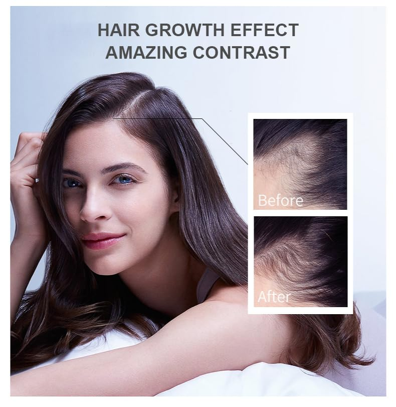 Hair Growth Oil Ginger Biotin  - Hair Care Essence Oil のレビューと価格