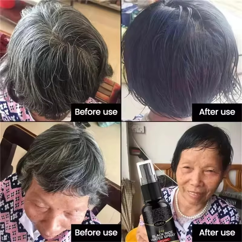 Gray White Hair Treatment Seru - Hair Care Ginseng のレビューと価格