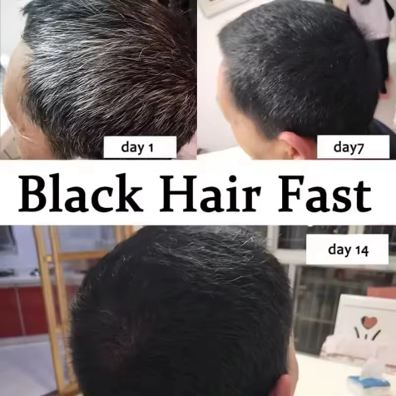 Gray White Hair Treatment Seru - Hair Care Ginseng のレビューと価格