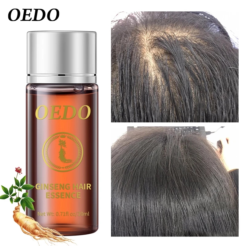 20ML Ginseng Hair Growth Essen - Hair Care Ginseng のレビューと価格