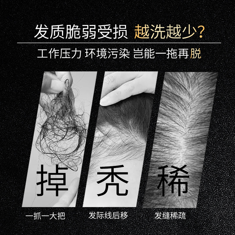 Famulan Anti Hair Loss Shampoo - Hair Care Normal のレビューと価格