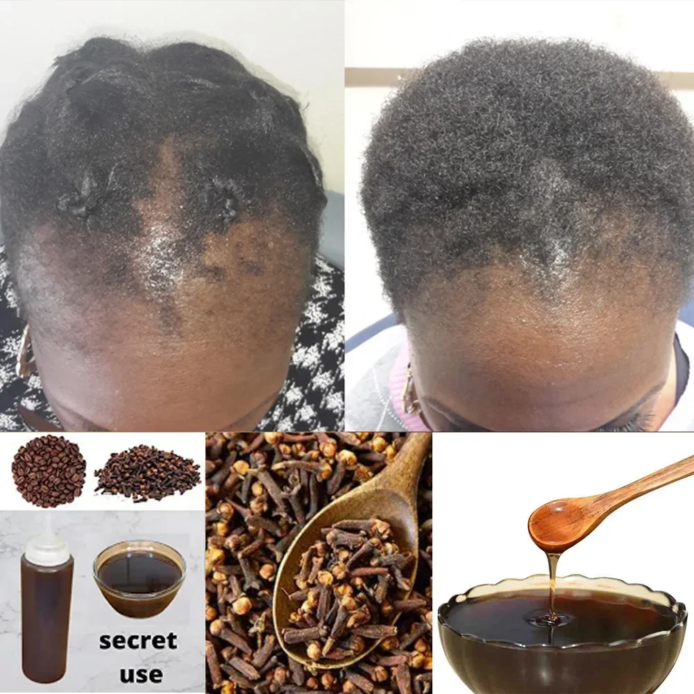 Africa Women Traction Alopecia - Hair Care Ginseng のレビューと価格