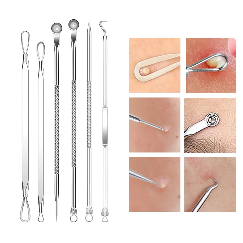 4-11Pcs Ingrown Hair Tweezers  - Hair Care Tools のレビューと価格
