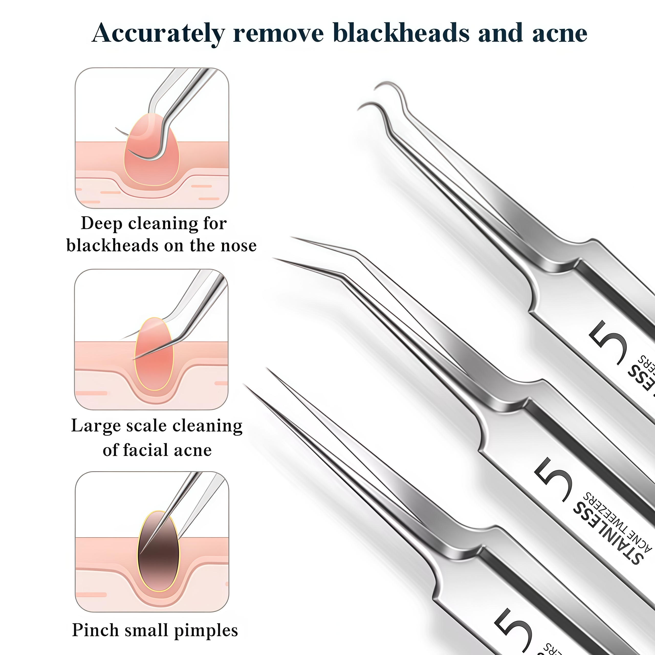 4-11Pcs Ingrown Hair Tweezers  - Hair Care Tools のレビューと価格