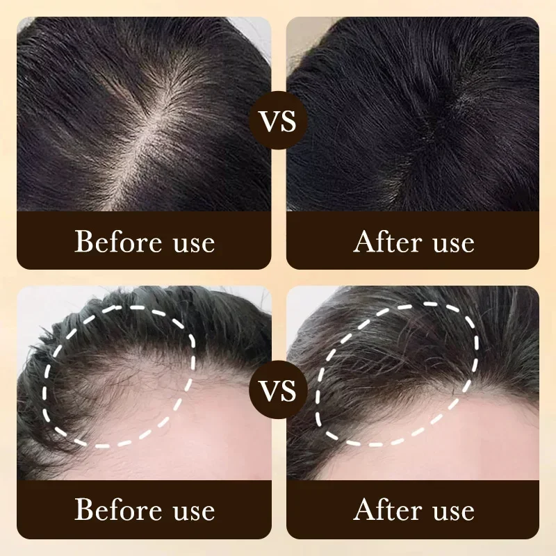 Biotin fast Hair Growth oil Pr - Hair Care Essence Oil のレビューと価格