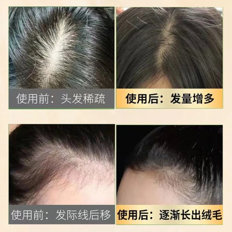 Natural Ginseng Hair Loss Care - Hair Care Ginseng のレビューと価格