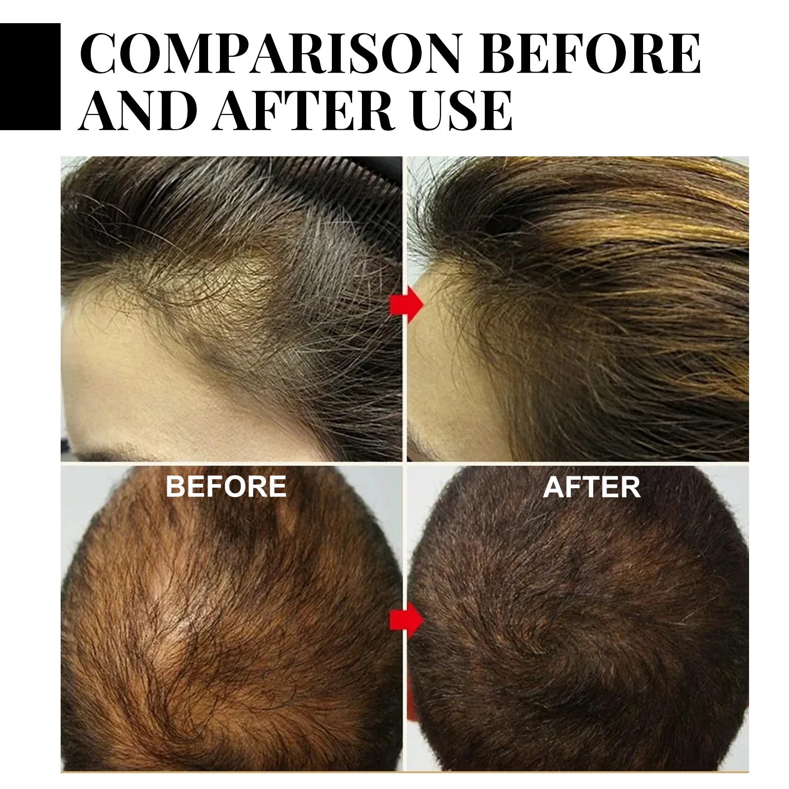 Fast Ginger Hair Growth Spray  - Hair Care Frizzy Hair のレビューと価格