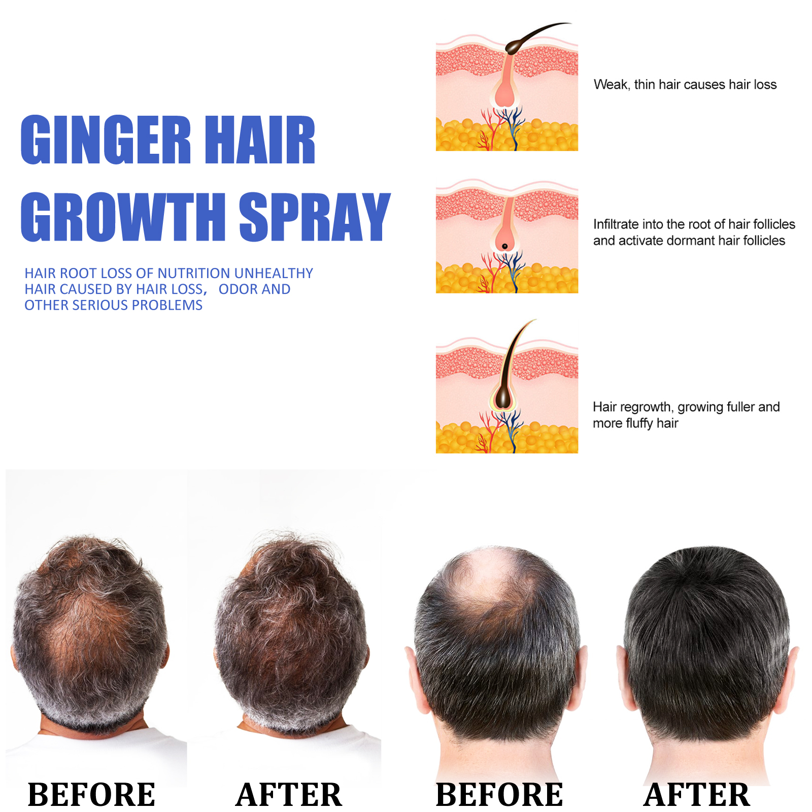 Fast Ginger Hair Growth Spray  - Hair Care Frizzy Hair のレビューと価格